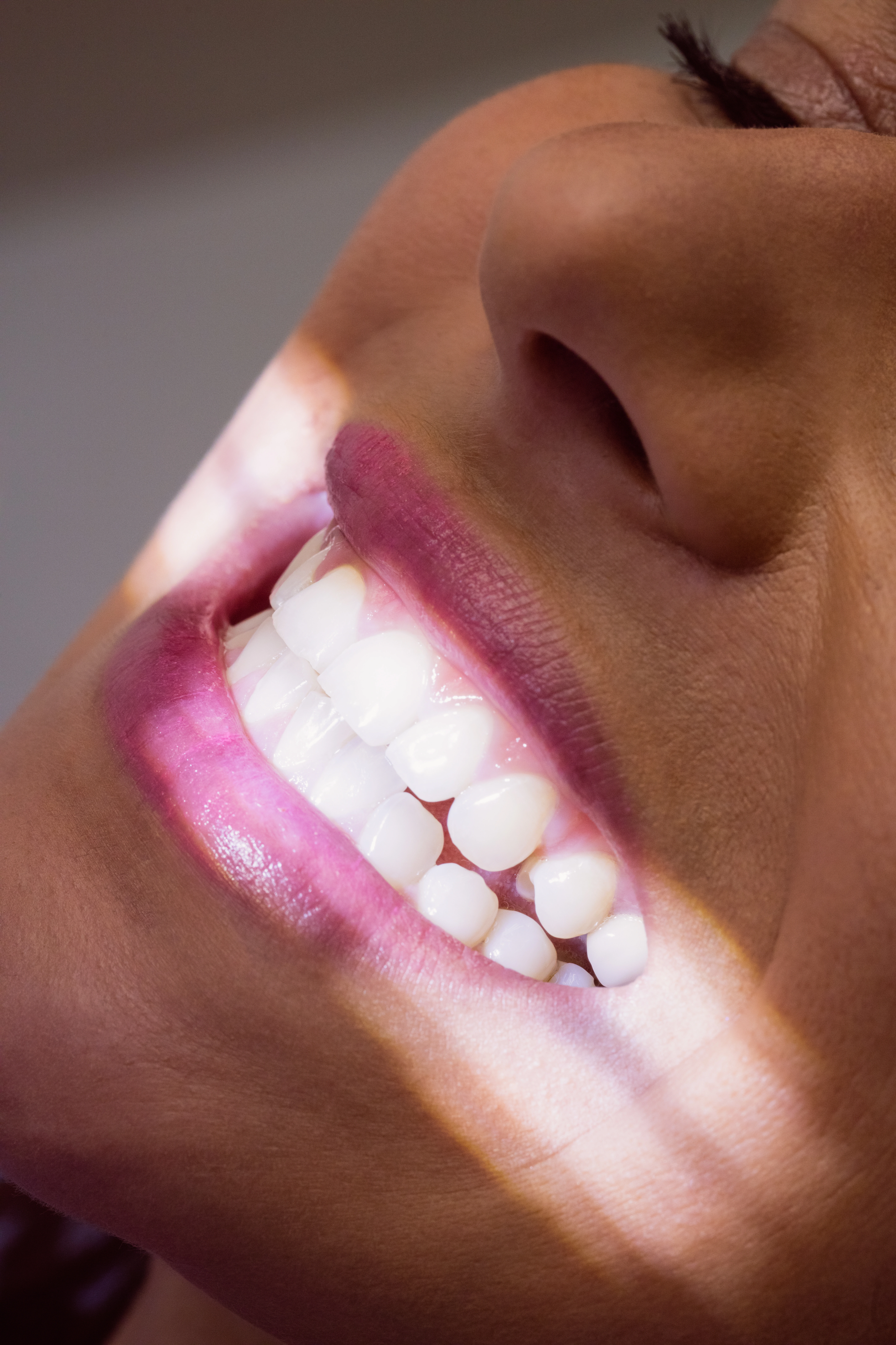 Tratamento odontológico Odonto Prime
